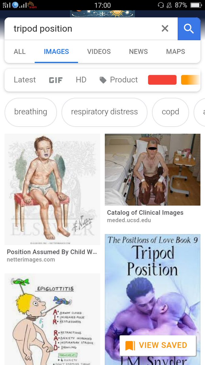 LouliGal's tweet image. While reviewing copd for finals

Okay.. 👀😂

#copd #visuallearner #extramile