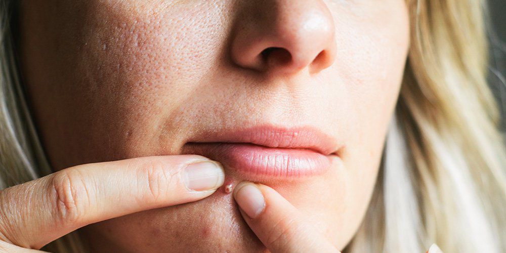 WomensHealthMag's tweet image. The removal of this 50-year-old cyst might be Dr. Pimple Popper's most disgusting video yet: spr.ly/6012DjhPG