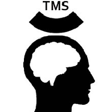 RevUpBilling's tweet photo. Skilled TMS billing for mental health providers. #mentalhealthbilling #TMSbilling #medicalbillinghelp https://t.co/FXBcXN8hgG