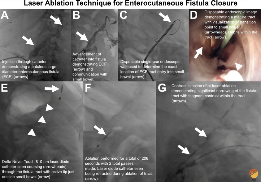 IRad Lab tweet media