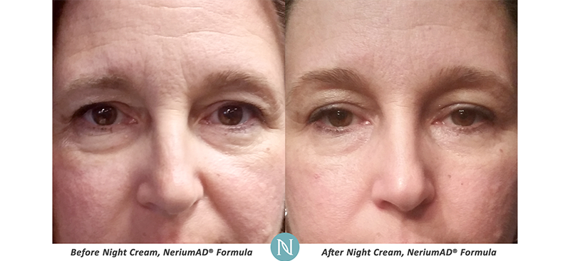 Emma_Lee989's tweet photo. Penny's 90 day results!! Holy smokes 😱😱😱 the best is her eyelid lift! https://t.co/DwlLeYaxMP
