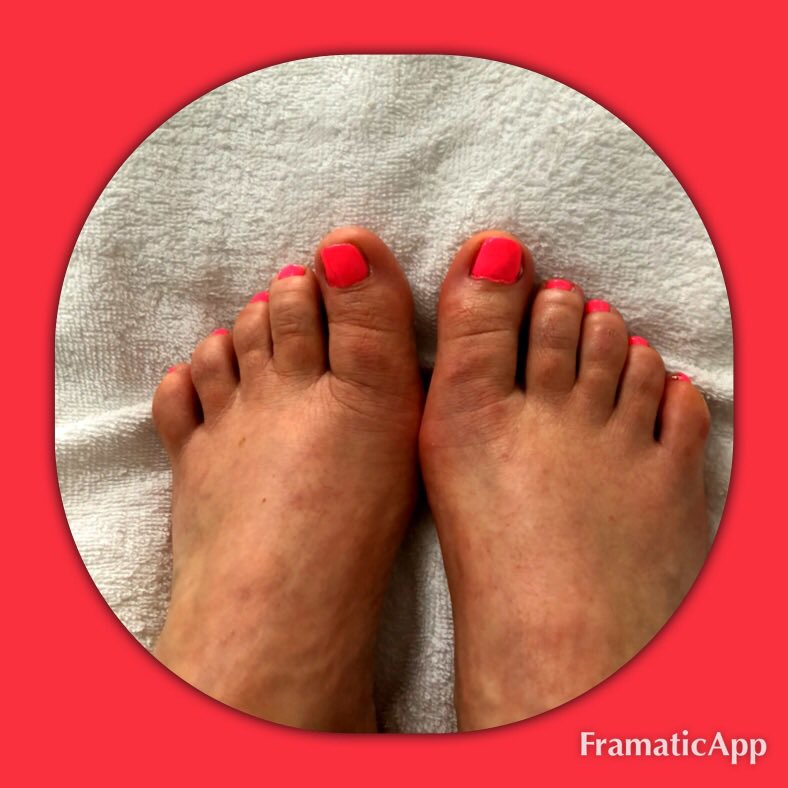 KuijkML's tweet image. Jetzt kann der Sommer kommen 🌞