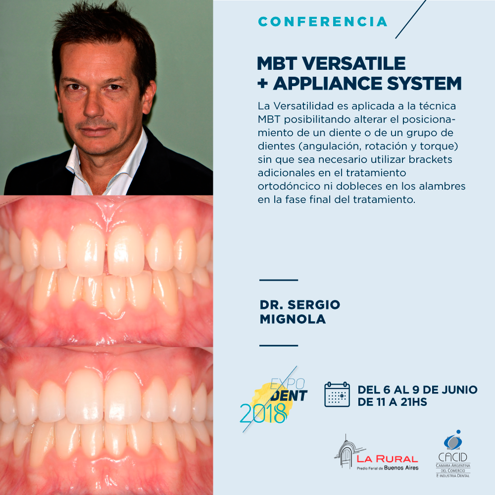 expodentBA's tweet photo. Avance // Conferencia
 
Dr. Sergio Mignola
MBT Versatile + Appliance System

> Inscribite! https://t.co/xghS6LRlAy <
 
Expodent 2018
La Rural – del 6 al 9 de Junio.
 
#expodentba2018 #Cámara #LaRural #stands #disertantes #conferencias #odontología https://t.co/7Xw34pngEM