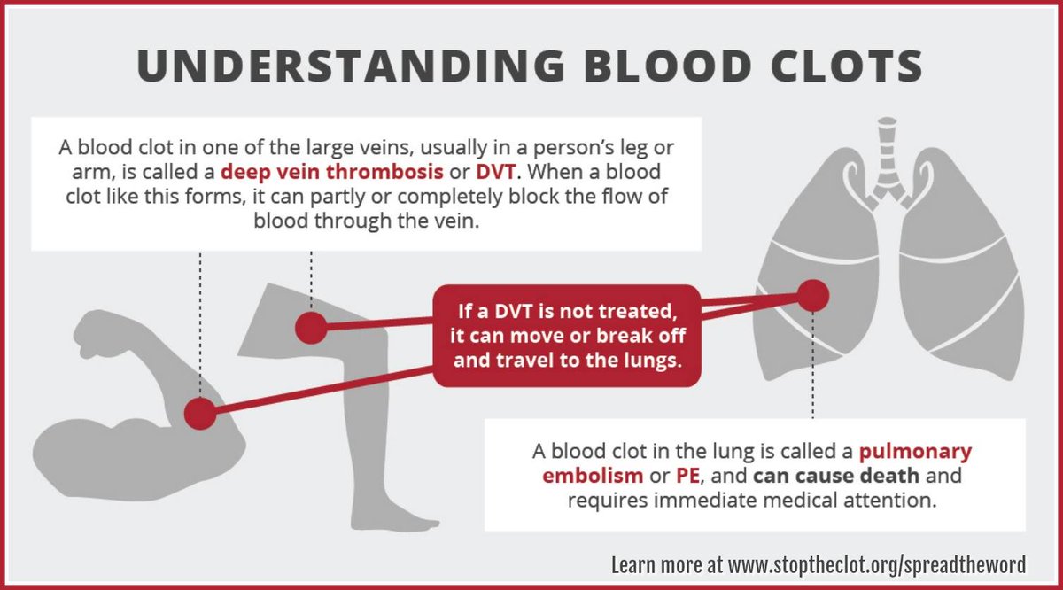 StopTheClot's tweet photo. A blood clot in the leg or arm (DVT) + a blood clot in the lung (PE) = venous thromboembolism (VTE). Learn more: https://t.co/GGmspAO7bP #stoptheclot #spreadtheword https://t.co/4HNqBBTq4g