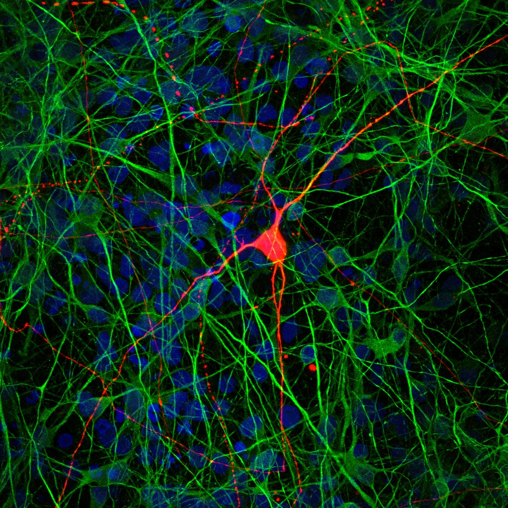 salkinstitute's tweet photo. Using multiple types of cells found in the brain’s #hippocampus, Salk researchers modeled how connections between cells go awry in #schizophrenia https://t.co/iT9Xc1iXBn https://t.co/BKF74ZAOI2