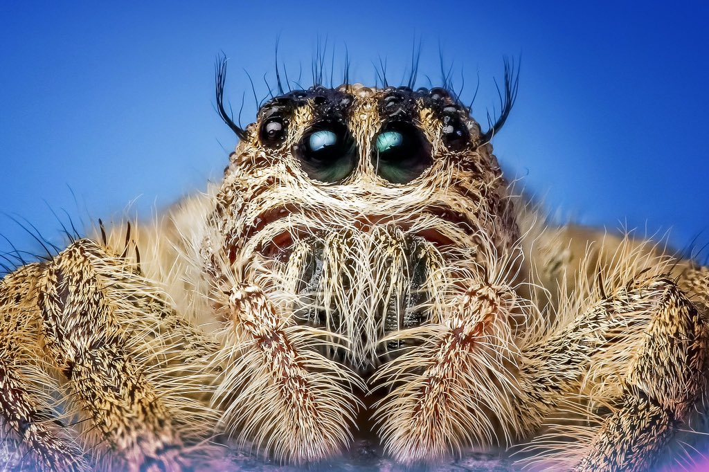 ClowdeeVape's tweet photo. Hyperfeminine spider just had a #sebaceous #cyst #lanced
#tokerware #medical #CBD #nurse #foodie #cannabis #CEO https://t.co/TxTNZwDtLm