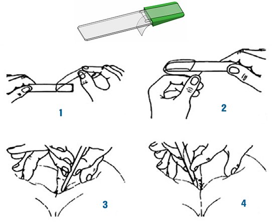 Jorge Ligero on X: "El diagnóstico se puede hacer mediante un análisis de  las heces para intentar ver los huevos o los adultos, pero tiene una baja  rentabilidad (10-15% en el mejor