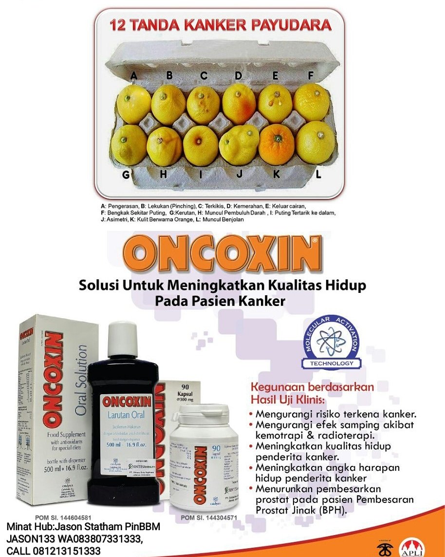 jasonstatham_go's tweet image. #kankerpayudara#kankerotak#kankerserviksoncoxin#kankerprostat#kankerpayudarastadium4#kankergetahbening