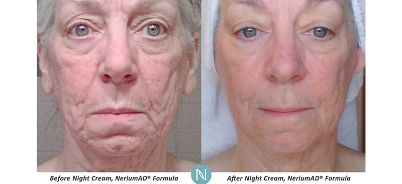 Emma_Lee989's tweet photo. OMG 😱  90 days consistency with the night cream, powerful mix antioxidants, feeding your skin to heal! 30 days or your money back ;) https://t.co/EGggCPyfIe