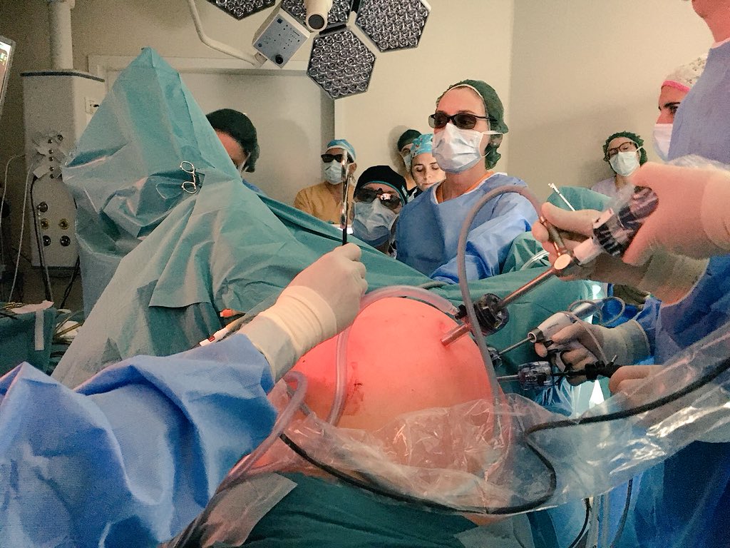 AnaOtero_MD's tweet photo. Enjoying a great surgery with a great team @AntoniodeLacy @RoelHompes at Rome #taTME International Congress #colorectalsurgery #cecilapproach https://t.co/Wr4cSHLlcN