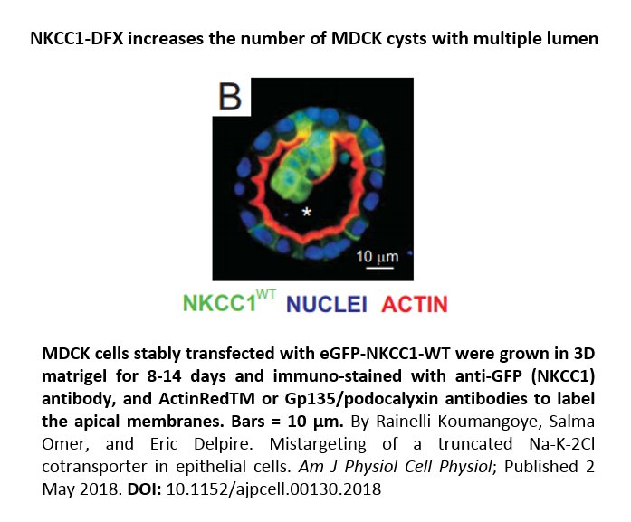 AJPCellPhys's tweet photo. This #ImageOfTheWeek comes from a research article about the “Mistargeting of a truncated Na-K-2Cl cotransporter in #EpithelialCells”. Read it here: https://t.co/4HtlavXw8k https://t.co/SFLiqQoYoc
