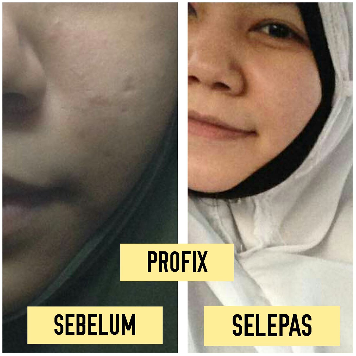 profixforever's tweet photo. Krim #profix ni sis memang RECOMMEND sebab sis pon pakai ok 😘 wajib try kalau nak cantik sebelum raya.  

Whatsapp sis cepat
👉 https://t.co/VXYQMwXtKP https://t.co/SJoKKlOyfs