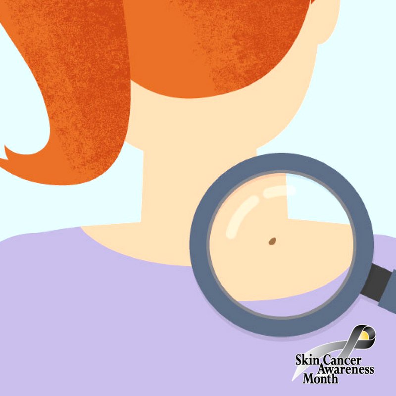 Now checking for signs of skin cancer can easily be done in your own home. Check out this helpful article to learn how to! #Brownderm #AAD #Skincancer ow.ly/dmeE30jJPbg