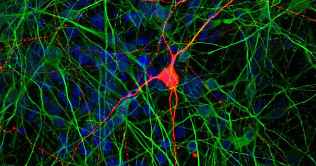 Yes, it's that time again for our weekly #StemCell Roundup: a better model of schizophrenia, fasting boosts #stemcells, & why does our hair gray. bit.ly/2wjw4rU