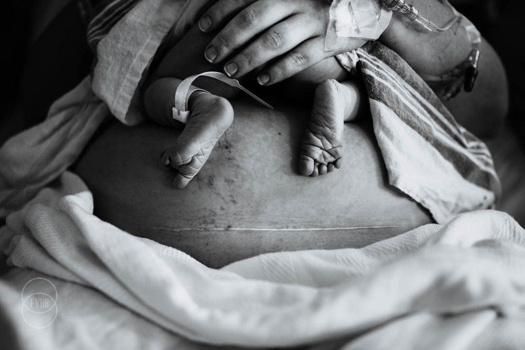 pregnantchicken's tweet photo. Birth photos aren't for everyone, but these stunning images truly highlight the strength, work, and magic of the process. Powerful images ahead - consider yourself warned! #birthphotography #birthmagic https://t.co/o6kiFs2HA9 via @PopSugarMoms https://t.co/nuZLgBB1cY