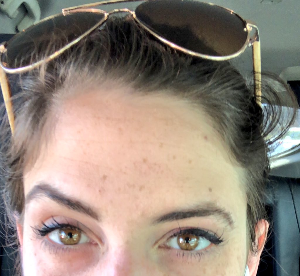 DivaJilly's tweet image. So this is after very haphazard use(3 days a week) of #rflashboost for #4weeks. These are 100% my natural lashes and benefit’s bad gal mascara. Definitely seeing growth on top and bottom lash lines. I’m going to start applying every other day for the next 2 weeks.