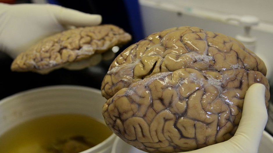 CBCQuirks's tweet photo. Forget cryogenics - scientists are working on a new way to immortalize your brain
https://t.co/7m5OiXFDQK
@Lets_Upgrade @MHendr1cks #brains #Immortality #cryogenics #Nectome https://t.co/irdyI57Uys