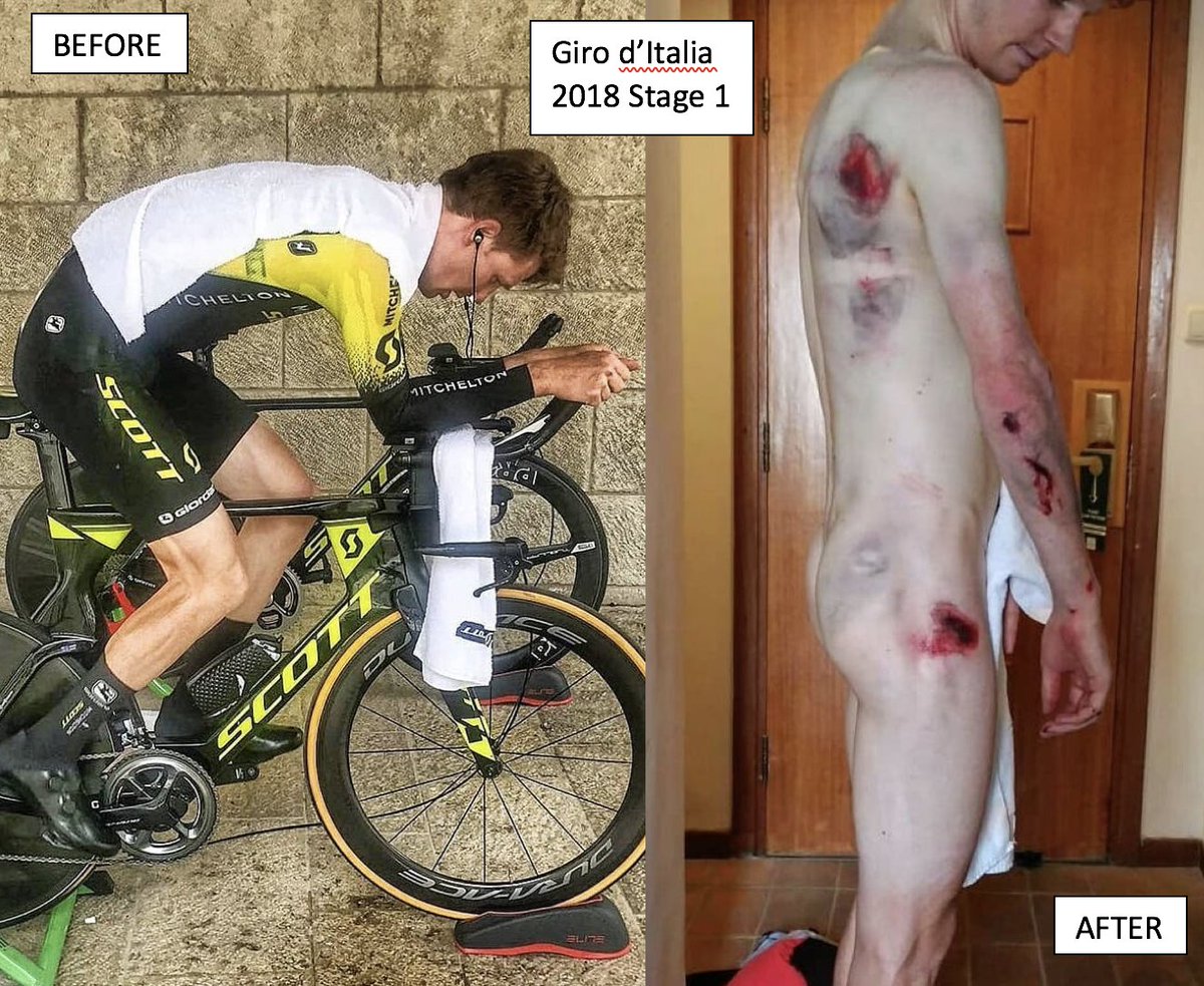 Ouch! Welcome to Israel <a href="/jackhaig93/">Jack Haig</a> 
<a href="/giroditalia/">Giro d'Italia</a> #ToughAsNails