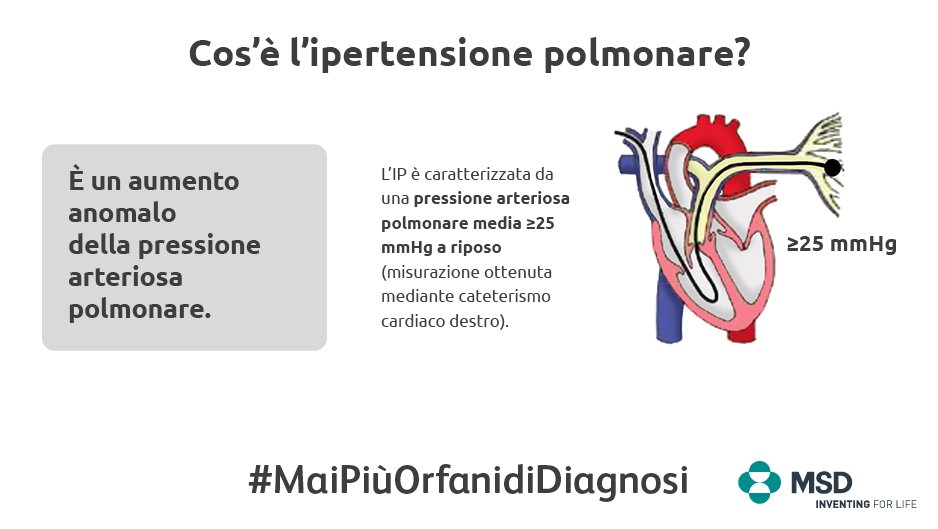 msdsalute's tweet photo. Cos'è l’Ipertensione Polmonare? #IpertensionePolmonare #MaiPiùOrfanidiDiagnosi #WorldPHDay #GlobalWave4PH https://t.co/eQiElulRug
