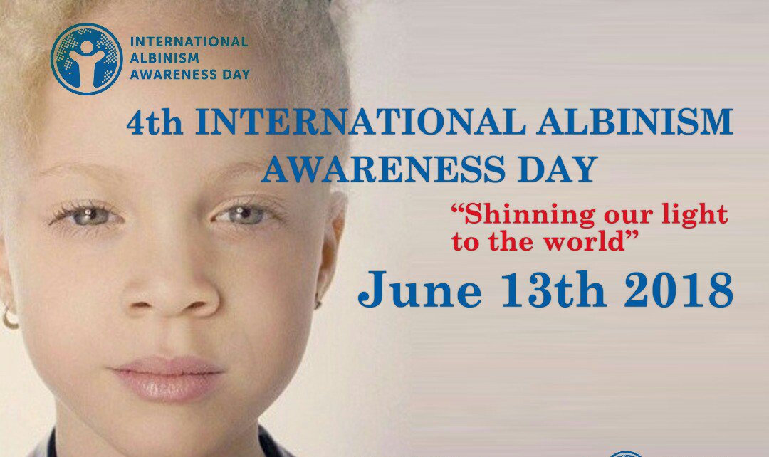 SOFU_UG's tweet image. 