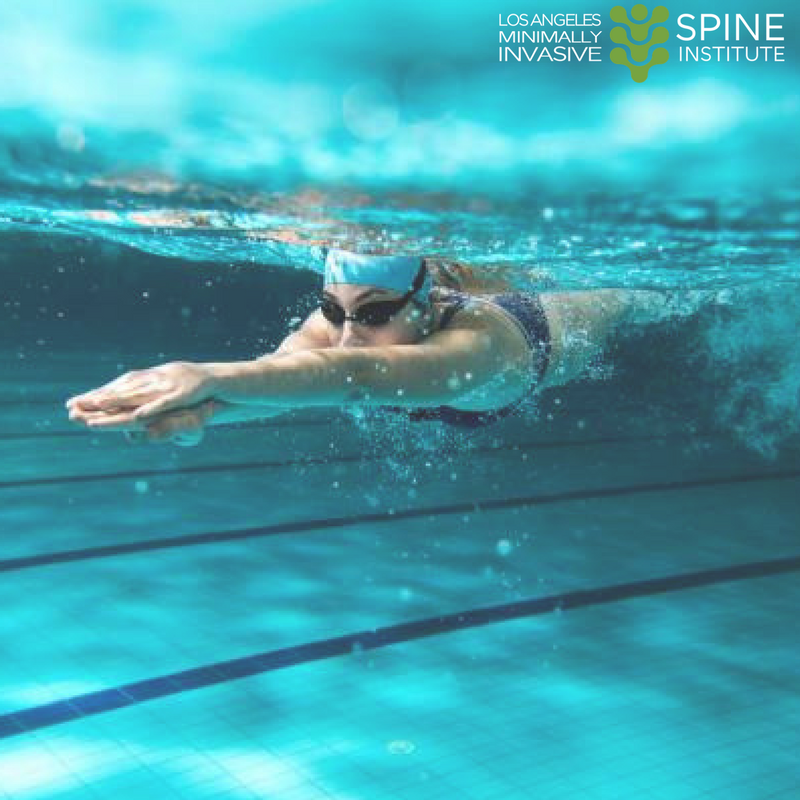 LASpinecare's tweet photo. Strained muscles and/or ligaments in the back are the most common cause of low back pain. Swimming provides a non-weight bearing environment in which to exercise these muscles, easing stress on all joints in the body and increasing range of motion. 

#sports #backpain #athlete https://t.co/Qjb3bpqIbe