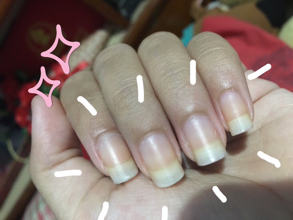 tkxmq_'s tweet photo. เล็บเหลืองไม่ได้เป็นโรค แต่ด้วยความที่ติดชอบทาเล็บ เล็บเลยเหลืองตลอดเว😂😂 แก้ไม่หาย เพื่อนแม่งบังคับซื้อ omgแกไม่ได้คิดว่าจะดีขนาดนี้ น้ำตาจะไหล ขอแชร์นะคะ ใครมีปัญหาเล็บเหลืองแบบเรา คือดีจิง เราใช้กล่องเดียว ซื้อมา190บาท 
#paraffinnailspa #HowtoPerfect #ไว้รีวิวห้ามขายของโว้ยย https://t.co/w6qEX6IdJ3