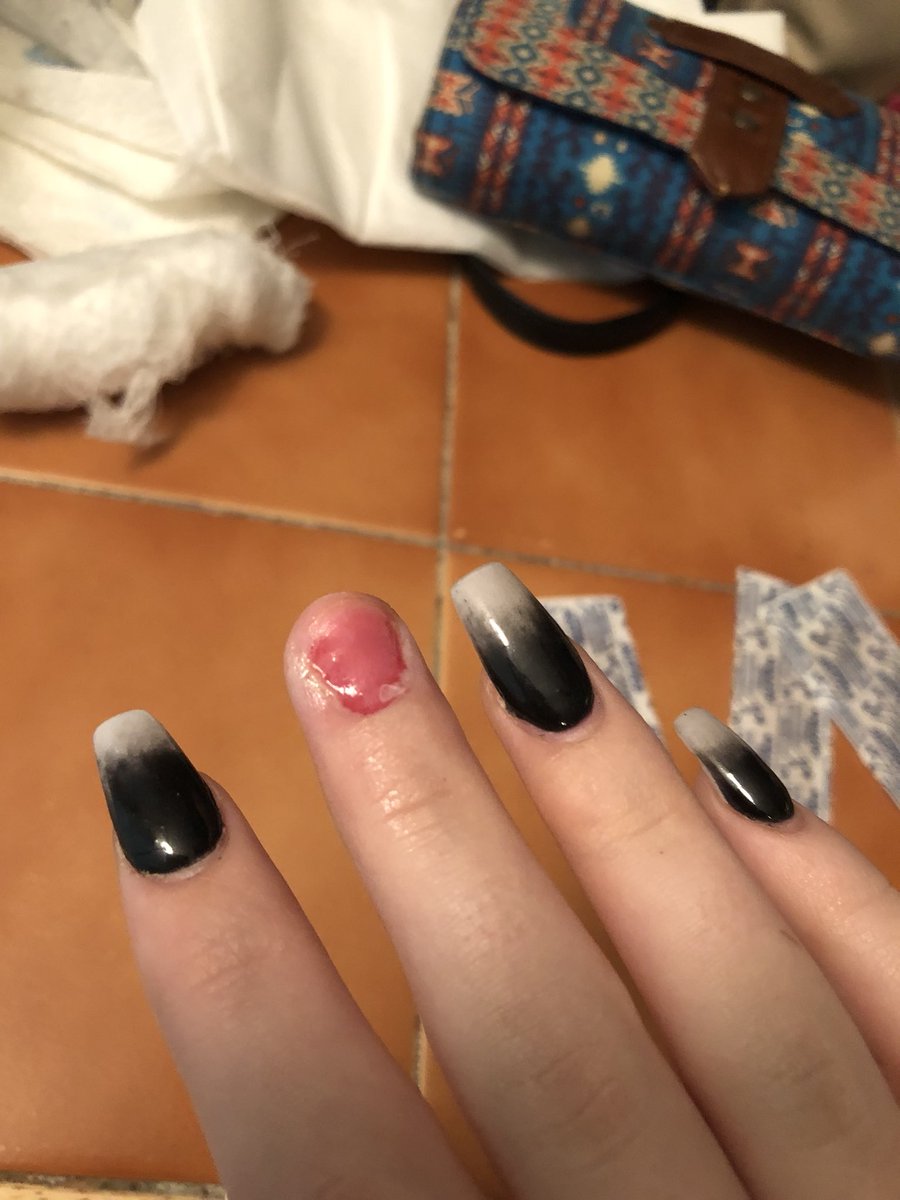 LocalEmilt's tweet photo. I have suffered one of the fake nail horror stories. https://t.co/wJzL6GYAiZ