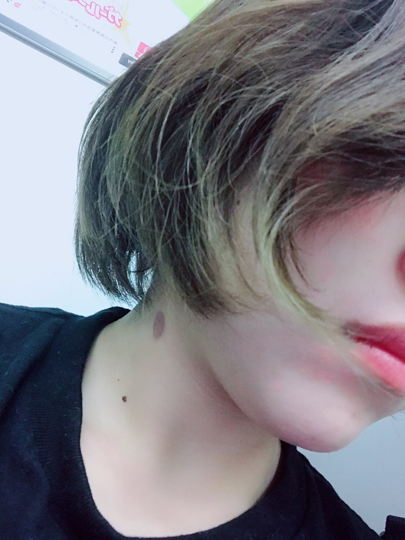 なおぴ No Twitter さっきトイレの鏡で気づいたんだけどさ 今朝ヘアアイロンしたら首火傷しちゃったのが 表れててキスマークみたいになってて草 しかも見つけたら痛くなるやつ 今さらヒリヒリしてきた なおぴ No Twitter さっきトイレの鏡で気づいたんだけどさ 今朝ヘアアイロンしたら首火傷しちゃったのが 表れててキスマークみたいになってて草 しかも見つけたら痛くなるやつ 今さらヒリヒリしてきた