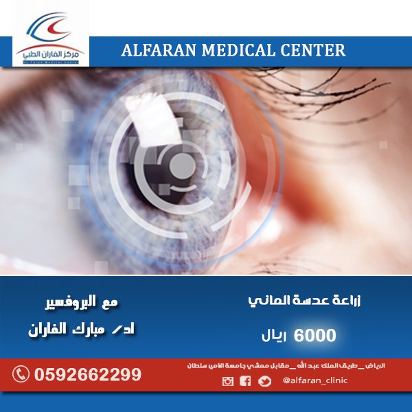 alfaran_clinic's tweet photo. تعتبر زراعة العدسات الدائمة داخل العين أحد الخيارات الجيدة 
لتصحيح عيوب الإبصار
 مثل قصر النظر فوق 9 درجات 
وطول النظر فوق 4 درجات.
 أو أن يكون سمك القرنية أقل من الطبيعي.
#زراعة_العدسات 
6000 ريال 
للمواعيد 
  0592662299
#الرياض #عيون #مبارك_الفاران #عمليات #تصحيح_نظر #ليزك_عيون https://t.co/lJM1zVfdr8