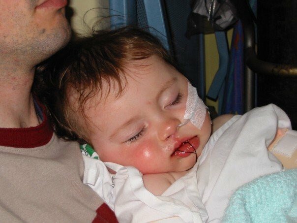 AliJaneWheeler's tweet photo. It’s Cleft Lip and Palate Awareness Week. These 2 inspire us everyday. #CLAPA #cleftlipandpalate https://t.co/Dn2NseVRmz