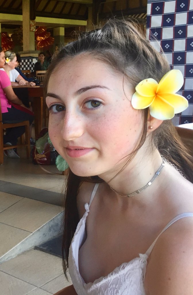 AliJaneWheeler's tweet photo. It’s Cleft Lip and Palate Awareness Week. These 2 inspire us everyday. #CLAPA #cleftlipandpalate https://t.co/Dn2NseVRmz