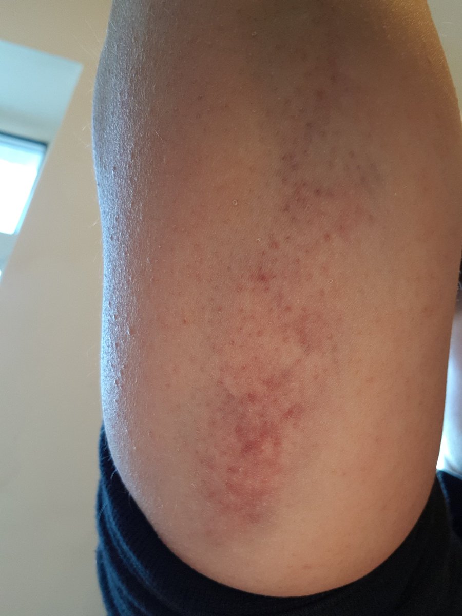 CooperCunt's tweet photo. Wtf did I do the other night 😂 https://t.co/fPsLXZQaAv