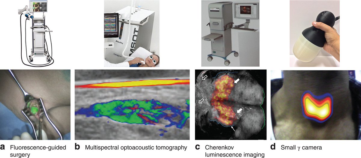 polom_karol's tweet image. Modalities for #imageguided + #molecularguided cancer surgery. nice review. #fluorescenceguided #multispectraloptoacoustictomography  #Cherenkovluminescence #γcamera and more pros and cons @BJSurgery onlinelibrary.wiley.com/doi/full/10.10…