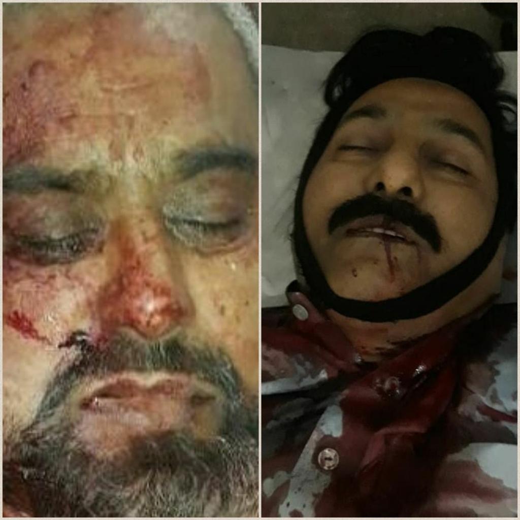 AWAZEHAQ110's tweet photo. ڈی آئی خان: تھانہ پروآ کی حدود میں میالی روڈ پر فائرنگ سے معروف شیعہ زمیندار منظور عباس انصاری شہید، ڈرائیور حافظ اللہ داد بھی زخموں کی تاب نہ لاتے ہوئے شہید ہوگئے۔
#ShiaGenocide #DIKhan @ImranKhanPTI https://t.co/2P1twwTi53