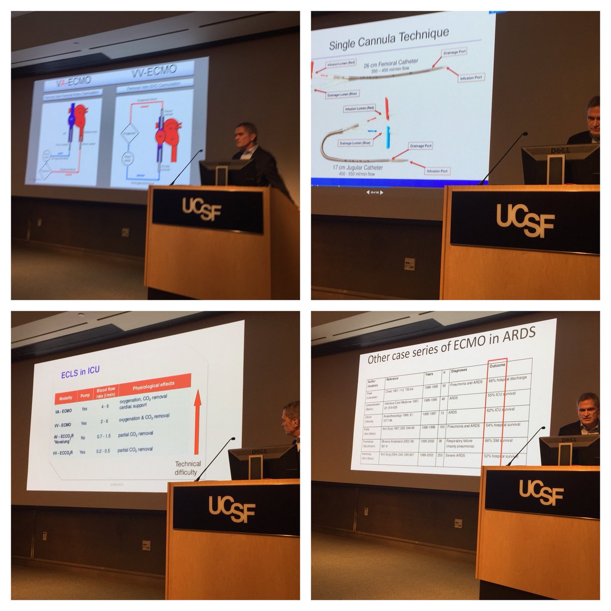 TraumaDocSF's tweet photo. Nice overview of the ECMO and its many uses after pulmonary or cardiac collapse. Full talk on https://t.co/IcuY7t6F4U. #ZSFGH @UCSFSurgery #TICS2018 @ucsf https://t.co/BaJqnsYR1Q