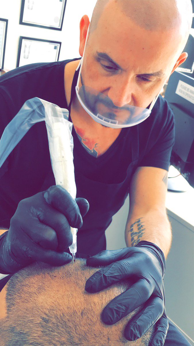 alwaysgorgeousu's tweet image. Doing what I love.. #scalpmicropigmentation #scalp #scalppigmentation