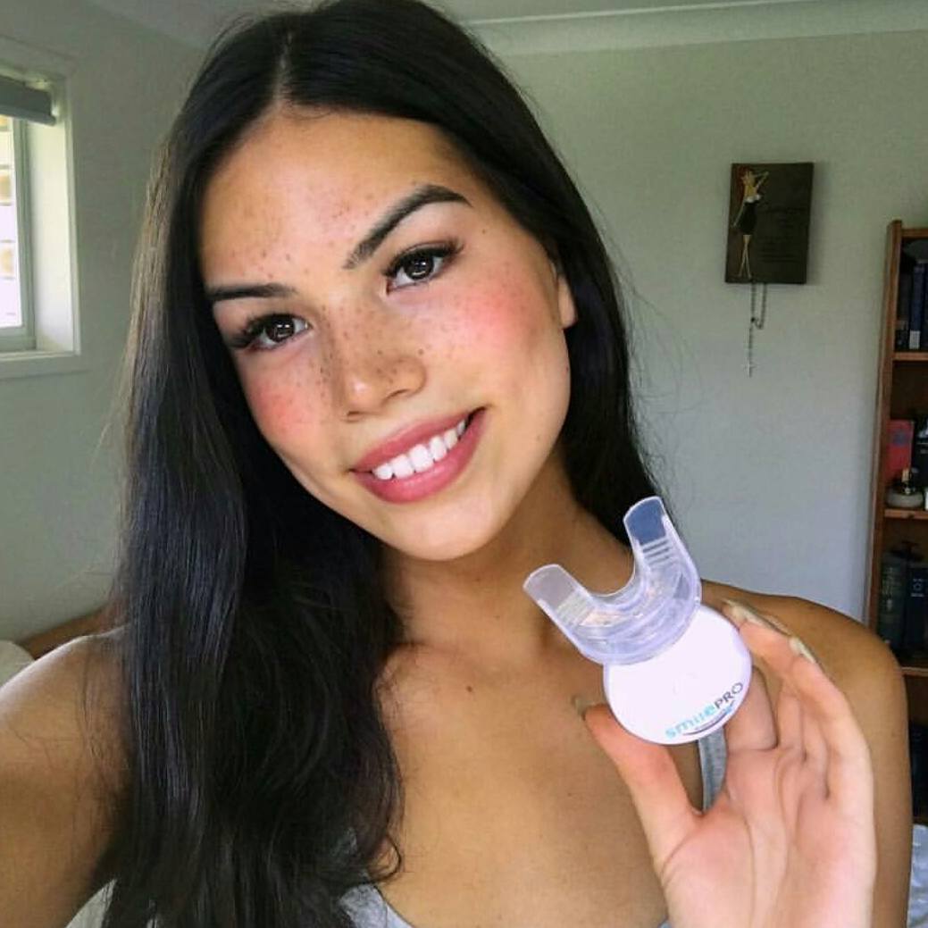 SmileProWW's tweet photo. 💎 Real people, Real results 💎

"So obsessed with my SmilePro Worldwide now you can't even tell I smoke a pack a day!! Stay pearly babes ✨" https://t.co/d7Pc3zuPuJ