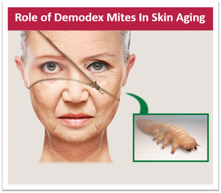 Masi_consultant's tweet photo. Did you know that #Demodex mites by nuitrishing on what is necessary for #skin cause or worsen #skin_aging.
For more information or to submit any questions👇
Online 247 chat:
https://t.co/O7IoIr8glO
Email:
masi@ungex.com https://t.co/6F4EPK3Fzf