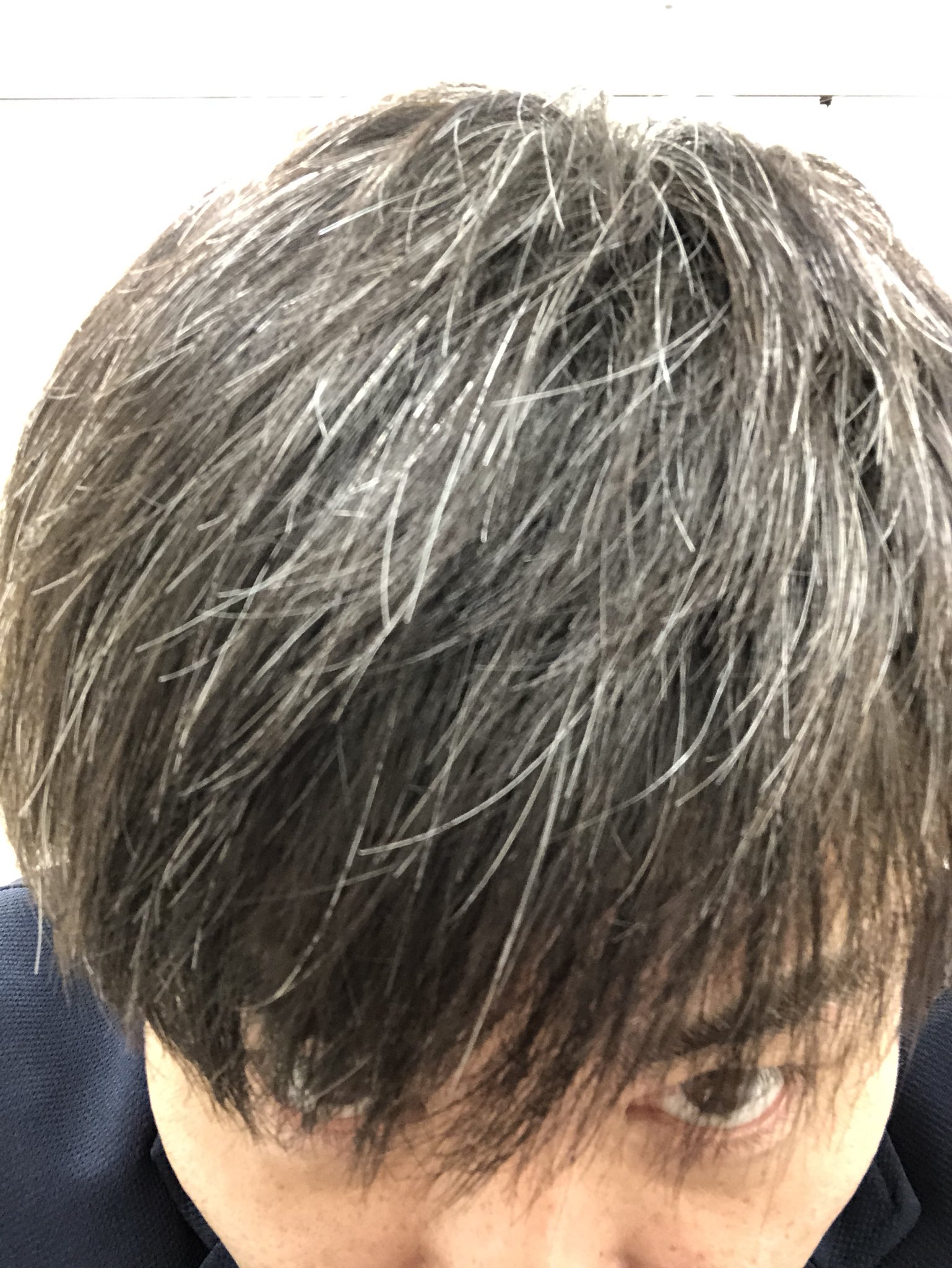 Twitter 上的 品川祐 白髪ハンパねえ 早く真っ白にならないかなぁ 白髪は染めない派 T Co Aiaqzorh6d Twitter
