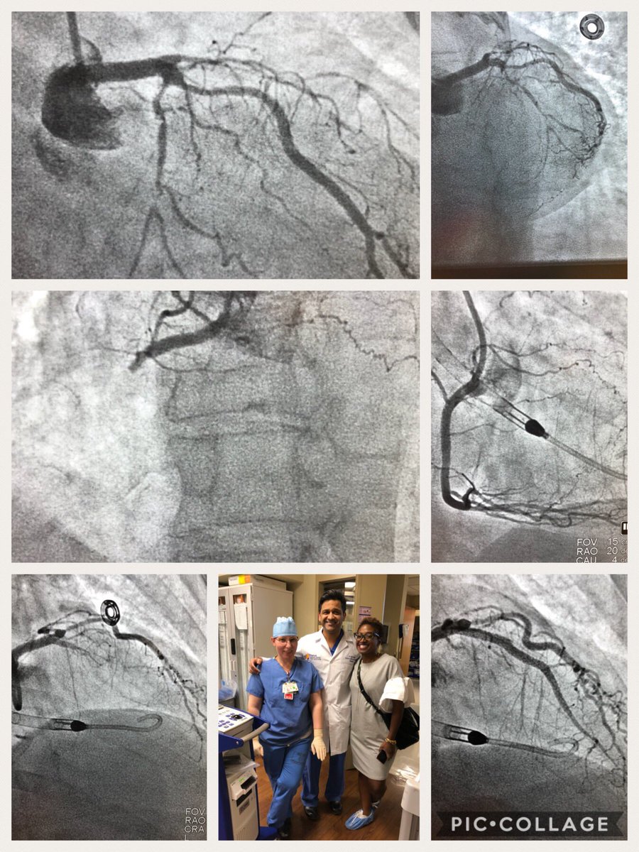 RajTayalMD's tweet photo. Congrats to the team @OverlookMedicalCenter on their first Impella case last night! #RadialFirst #radipella #gamechanger #thewaronshockbegins https://t.co/Pqmj8oexXe