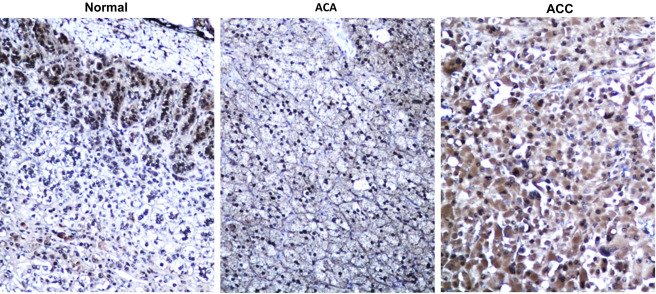 Journal of the American College of Surgeons (JACS) tweet media