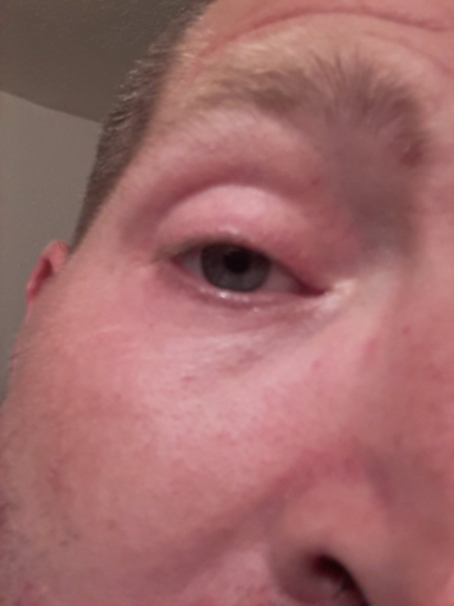 Topflight1978's tweet image. When you try to take a selfie when you are high!...he he  #holyshit #whaaaat #passthelighter #huh #teamfollowback #TopFlightforpresident2020