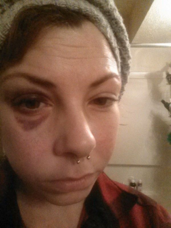 GeoffGilson's tweet photo. Problems persist for my friend Allie, who was viciously assaulted in February. Details - https://t.co/1GDAygKaqG. Her FMLA just ended. Please open hearts - and wallets (!) - to continue helping her and her son. GoFundMe - https://t.co/613SqvK7ps. Many thanks. https://t.co/1g6CWsLu3O