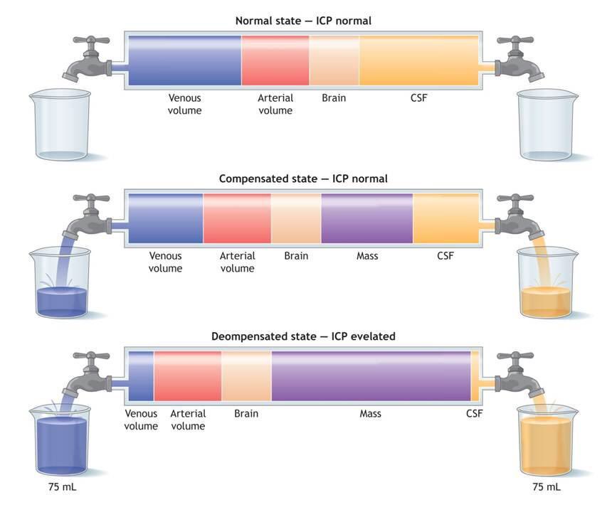 Descubre la Teoría de Monro Kelly: Clave para el Éxito en tu Negocio Teoria de monro kelly
