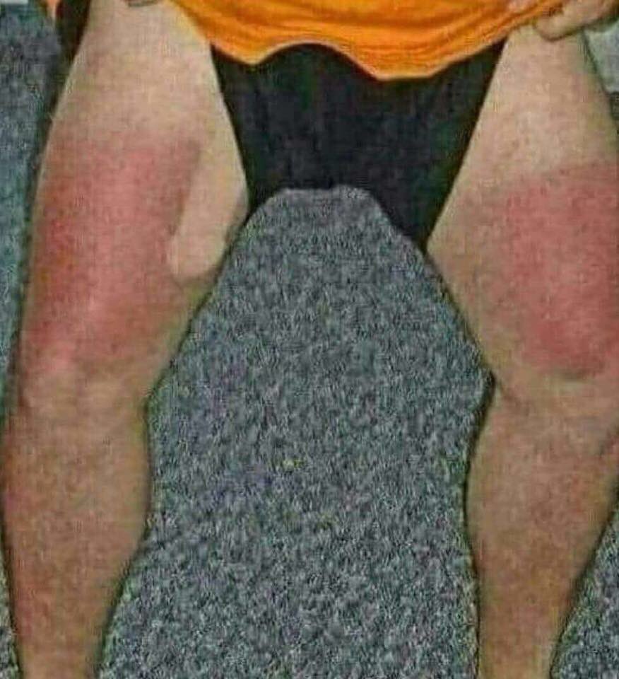 suave_simon's tweet photo. Ahhhhh......fell asleep in the sun this afternoon https://t.co/XqL7Sb7a5t