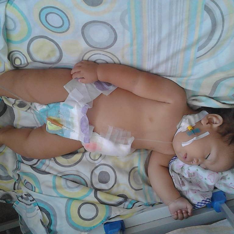 ESEdeSalud's tweet image. Gabriela (10 meses). Fístula. Operada en HCM. NECESITA Longacef 100mg/ml. Overskin 40%. Ibuprofeno 200mg/5ml, Gasas, Pañales, Adhesivo, Acetaminofén pediátrico, centro cama y Gel antibacterial. 
#Cagua @FundacionFE1 

#ServicioPublico * Retwee y ayuda a difundir!! #ESEdeSalud