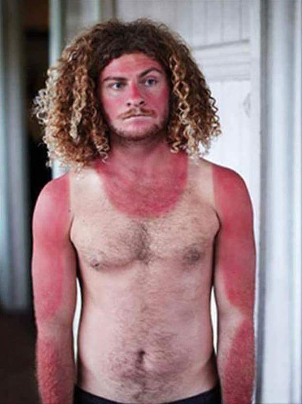 EmmaJarvis36's tweet photo. Ffs this is so me this bank holiday 😂😂😂😂 #PaleSkin #Fleckles #ShouldBeGinger 🙈🙈🙈 https://t.co/BuPTtiKhNq