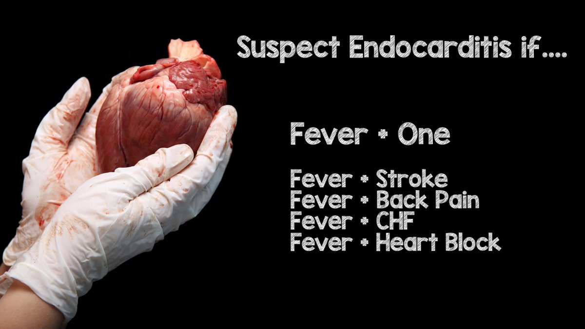 EndoCARRditis Will Also F&*k You Up via @davidcarr333 intensivecarenetwork.com/endocarditis-w… #FOAMed #dasSMACC

Usual Suspects: Hx of Valve Replacement, IVDU, Cancer, Lupus
Fever + One (Stroke, Back Pain, CHF, Heart Block) = Suspect IE