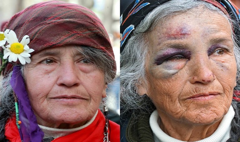 "Son Nefesime Kadar Direnmeye Devam Edeceğim"

75 yaşında polis şiddetinin hedefi olan Perihan Pulat Enver Aysever'e anlattı;

"100 yaşıma kadar yaşayacağım. Ayakta dimdik duracağım.”

aykiriakademi.com/dusunce-balonu…