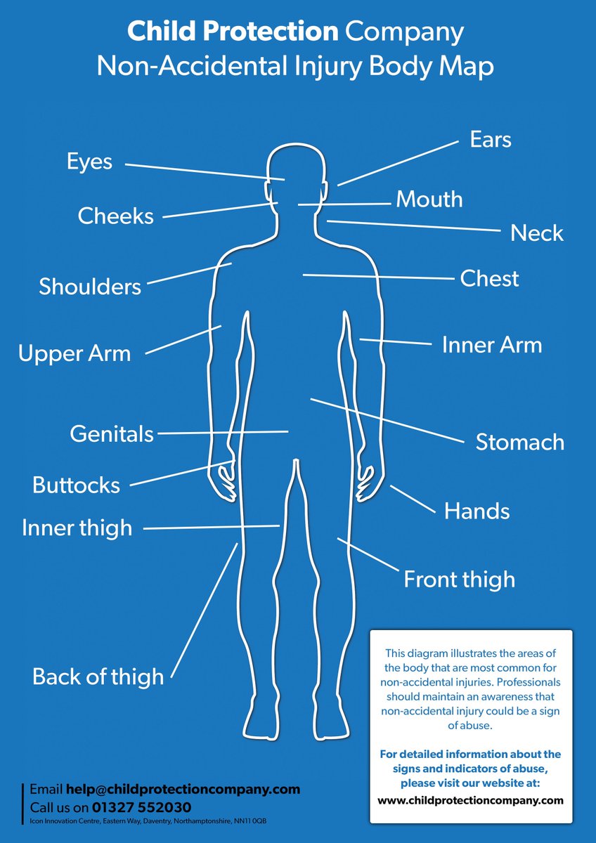 Child Protection Company on Twitter: